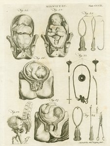 助産術、「百科事典ブリタニカ」のイラスト、エジンバラ、1798年に発行（銅版画） 作： Alexander Bell